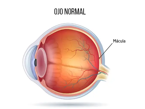 //oftalmologoensaltillo.com.mx/wp-content/uploads/2021/02/agujero-macular.png